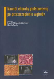 Okładka książki Nawrót choroby podstawowej po przeszczepieniu wątroby