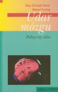 Okładka książki Udar mózgu