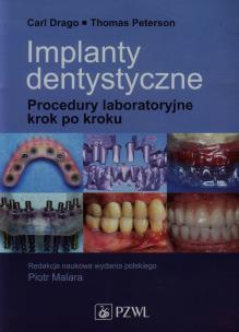 Okładka książki Implanty dentystyczne. Procedury laboratoryjne
