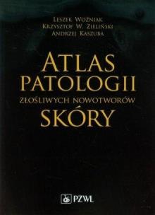 Okładka książki Atlas patologii złośliwych nowotworów skóry