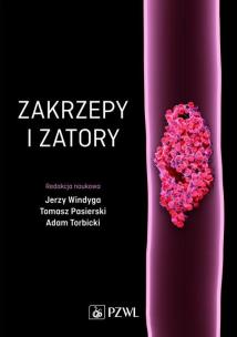 Okładka książki Zakrzepy i zatory