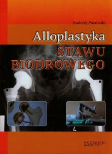 Okładka książki Alloplastyka stawu biodrowego