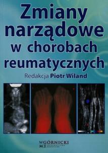 Okładka książki Zmiany narządowe w chorobach reumatycznych