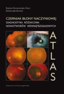 Okładka książki Czerniak błony naczyniowej Atlas