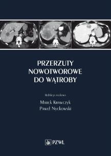 Okładka książki Przerzuty nowotworowe do wątroby