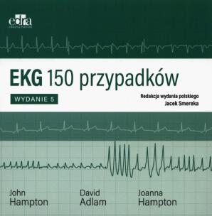 Okładka książki EKG 150 przypadków