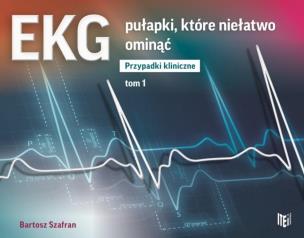 Okładka książki EKG pułapki, które niełatwo ominąć Przypadki kliniczne Tom 1