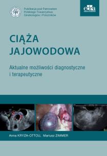 Okładka książki Ciąża jajowodowa Aktualne możliwości diagnostyczne i terapeutyczne