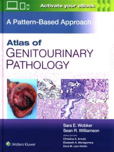 Okładka książki Atlas of Genitourinary Pathology