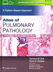 Okładka książki Atlas of Pulmonary Pathology