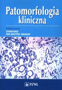 Patomorfologia kliniczna. Autor: Kruś Stefan, Ewa Skrzypek-Fakhoury. Multiszop.pl Okładka książki Patomorfologia kliniczna