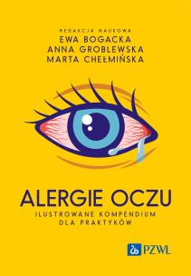 Alergie oczu. Ilustrowane kompendium dla praktyków. Autor: Bogacka Ewa, Groblewska Anna, Chełmińska Marta. Multiszop.pl Okładka książki Alergie oczu. Ilustrowane kompendium dla praktyków
