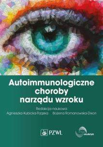 Autoimmunologiczne choroby narządu wzroku. Autor: Kubicka-Trząska Agnieszka, Romanowska-Dixon Bożena. Multiszop.pl Okładka książki Autoimmunologiczne choroby narządu wzroku