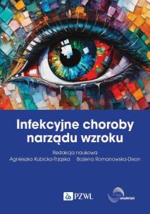 Infekcyjne choroby narządu wzroku. Autor: Kubicka-Trząska Agnieszka, Romanowska-Dixon Bożena. Multiszop.pl Okładka książki Infekcyjne choroby narządu wzroku