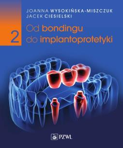 Od bondingu do implantoprotetyki. Cz. II. Autor: Wysokińska-Miszczuk Joanna, Jacek Ciesielski. Multiszop.pl Okładka książki Od bondingu do implantoprotetyki. Cz. II