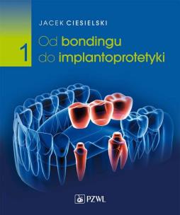 Od bondingu do implantoprotetyki Część 1. Autor: Jacek Ciesielski. Multiszop.pl Okładka książki Od bondingu do implantoprotetyki Część 1