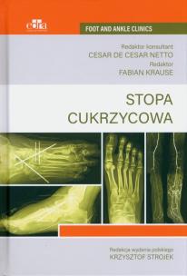 Opakowanie Stopa cukrzycowa
