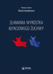 Okładka książki Złamania wyrostka kłykciowego żuchwy
