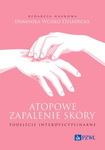 Atopowe zapalenie skóry Podejście interdyscyplinarne. Autor: Wcisło-Dziadecka Dominika. Multiszop.pl Okładka książki Atopowe zapalenie skóry Podejście interdyscyplinarne