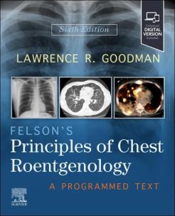 Okładka książki Felson's Principles of Chest Roentgenology