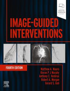 Okładka książki Image-Guided Interventions