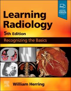 Okładka książki Learning Radiology