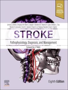 Okładka książki Stroke. Pathophysiology, Diagnosis, and Management