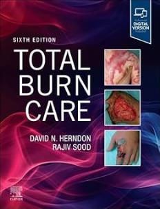 Okładka książki Total Burn Care