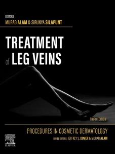 Okładka książki Treatment of Leg Veins