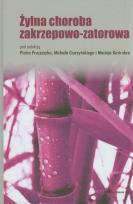 Opakowanie Żylna choroba zakrzepowo-zatorowa