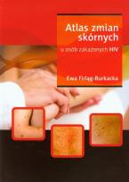 Okładka książki Atlas zmian skórnych u osób zakażonych HIV
