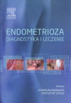 Opakowanie Endometrioza diagnostyka i leczenie