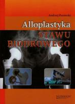 Okładka książki Alloplastyka stawu biodrowego