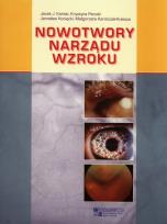 Okładka książki Nowotwory narządu wzroku