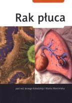 Okładka książki Rak płuca