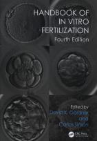 Okładka książki Handbook of In Vitro Fertilization