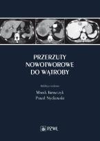 Okładka książki Przerzuty nowotworowe do wątroby