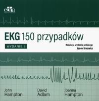 Okładka książki EKG 150 przypadków