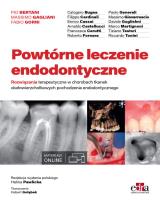 Okładka książki Powtórne leczenie endodontyczne