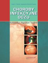 Okładka książki Choroby infekcyjne oczu