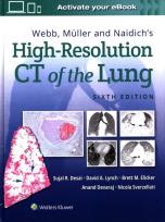 Okładka książki Webb, Müller and Naidich's High-Resolution CT of the Lung Sixth edition