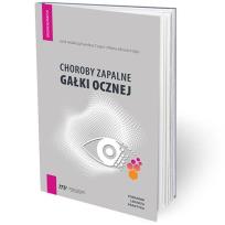 Okładka książki Choroby zapalne gałki ocznej - poradnik lekarza pr