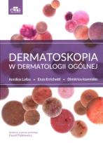 Okładka książki Dermatoskopia w dermatologii ogólnej