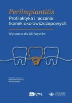 Okładka książki Periimplantitis. Profilaktyka i leczenie tkanek okołowszczepowych