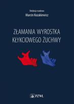 Okładka książki Złamania wyrostka kłykciowego żuchwy