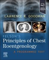 Okładka książki Felson's Principles of Chest Roentgenology