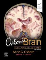 Okładka książki Osborn'S Brain