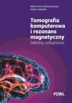 Okładka książki Tomografia komputerowa i rezonans magnetyczny