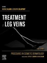 Okładka książki Treatment of Leg Veins